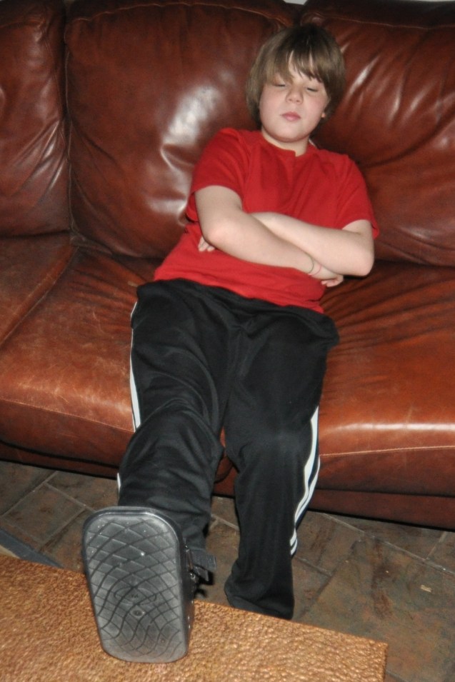 Sprained cracked ankle in boot